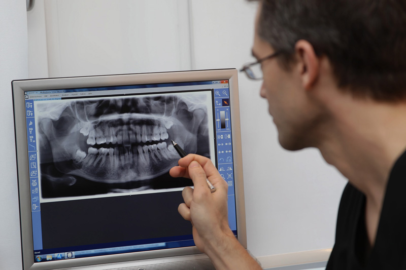 Weil unsere Operationen in einem hochsensiblen und komplexen Bereich des menschlichen Körpers stattfinden, setzen wir auf präzise Diagnostik mit digitaler Röntgen-Technik.
