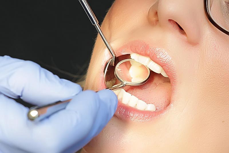 Wir sind Spezialisten, wenn es z. B. darum geht, Weisheitszähne zu entfernen, Zähne chirurgisch durch Wurzelspitzenresektion (WSR) zu erhalten oder Parodontitis zu behandeln.